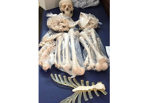 bone-set